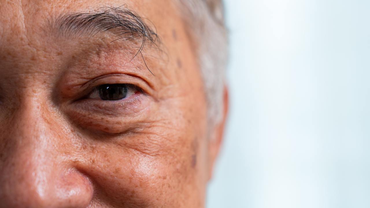 aposentadoria visão monocular